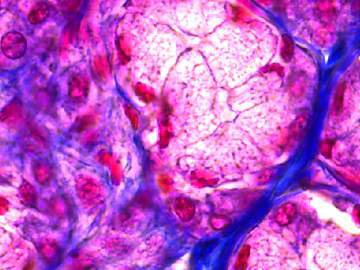 Thumbnail ofParotid_gland_12_bit.jpg